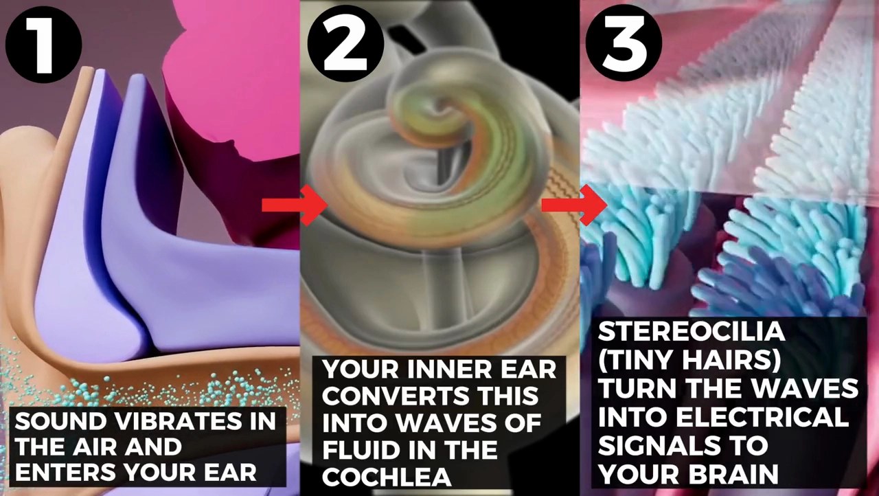 Three-stage diagram of how sound travels through the ear to the brain