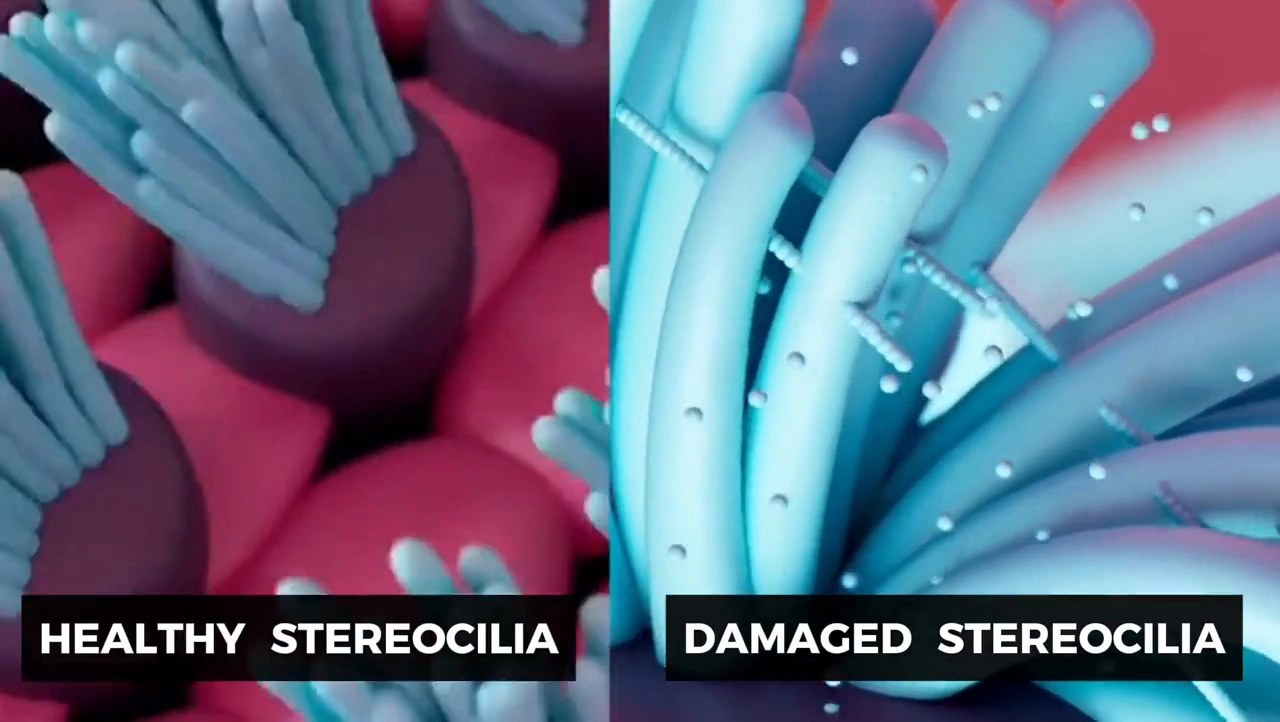 Comparison of healthy stereocilia against damaged stereocilia